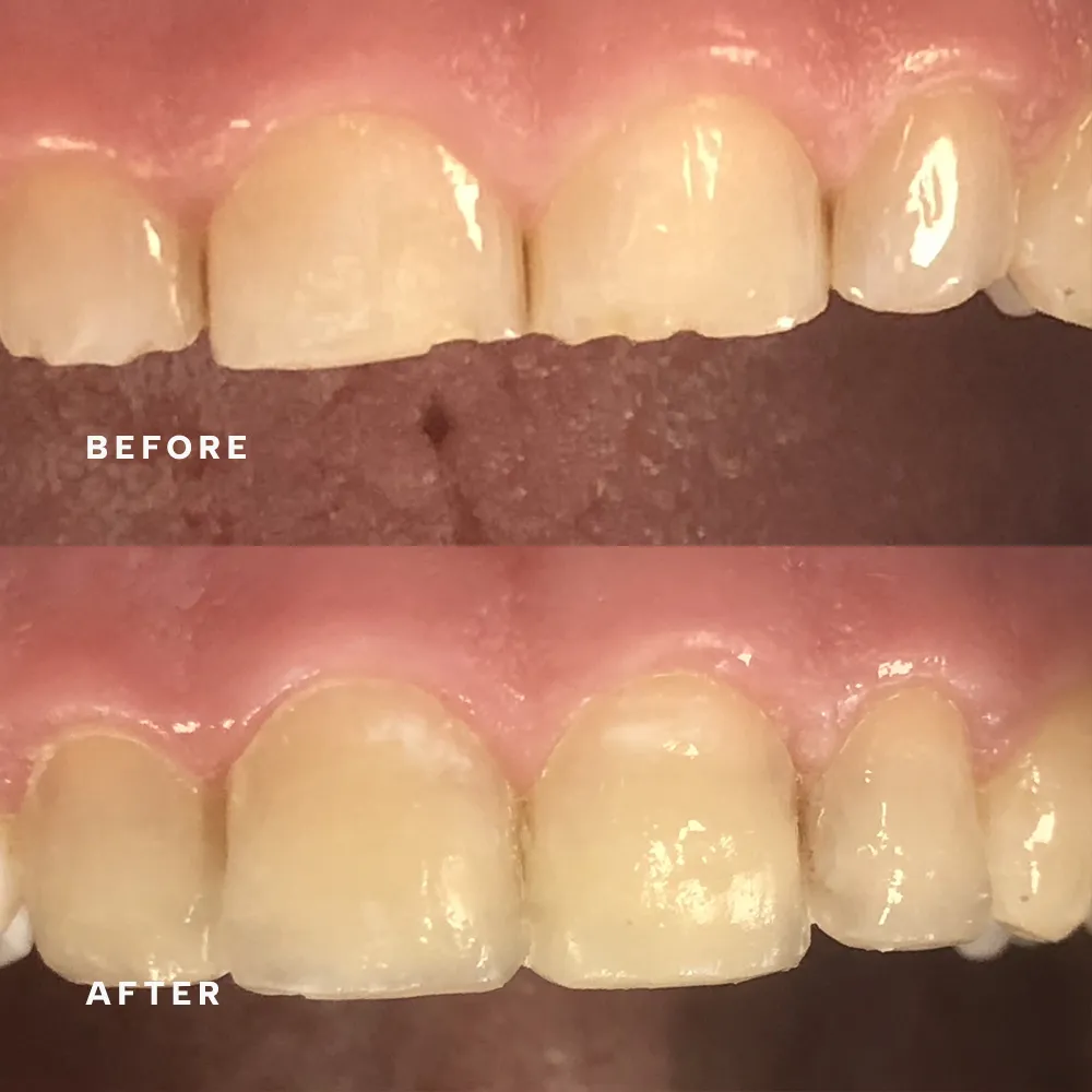 Before and after: treatment by Dr Dorothy Riley (before above, after below)
