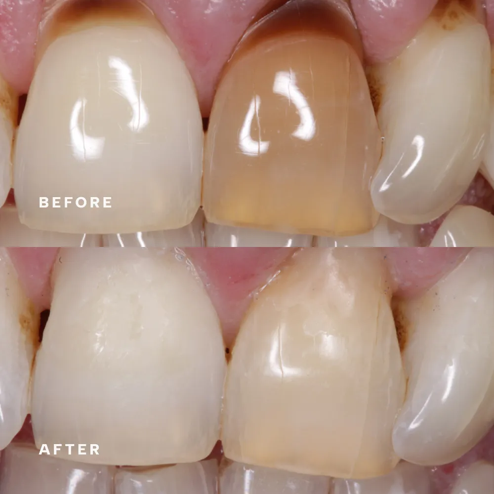 Before (top) and after (bottom): treatment by dr dorothy riley