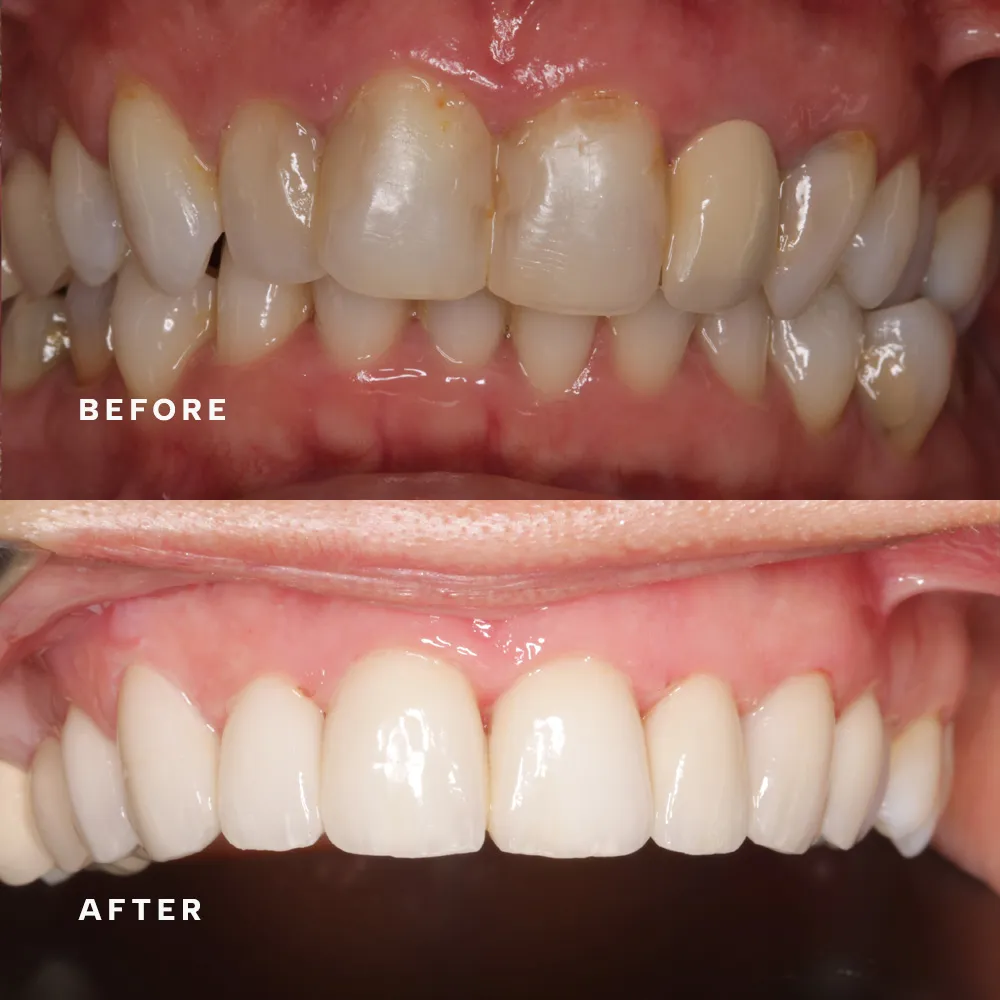 Before and after: treatment by Dr Dorothy Riley (before above, after below)